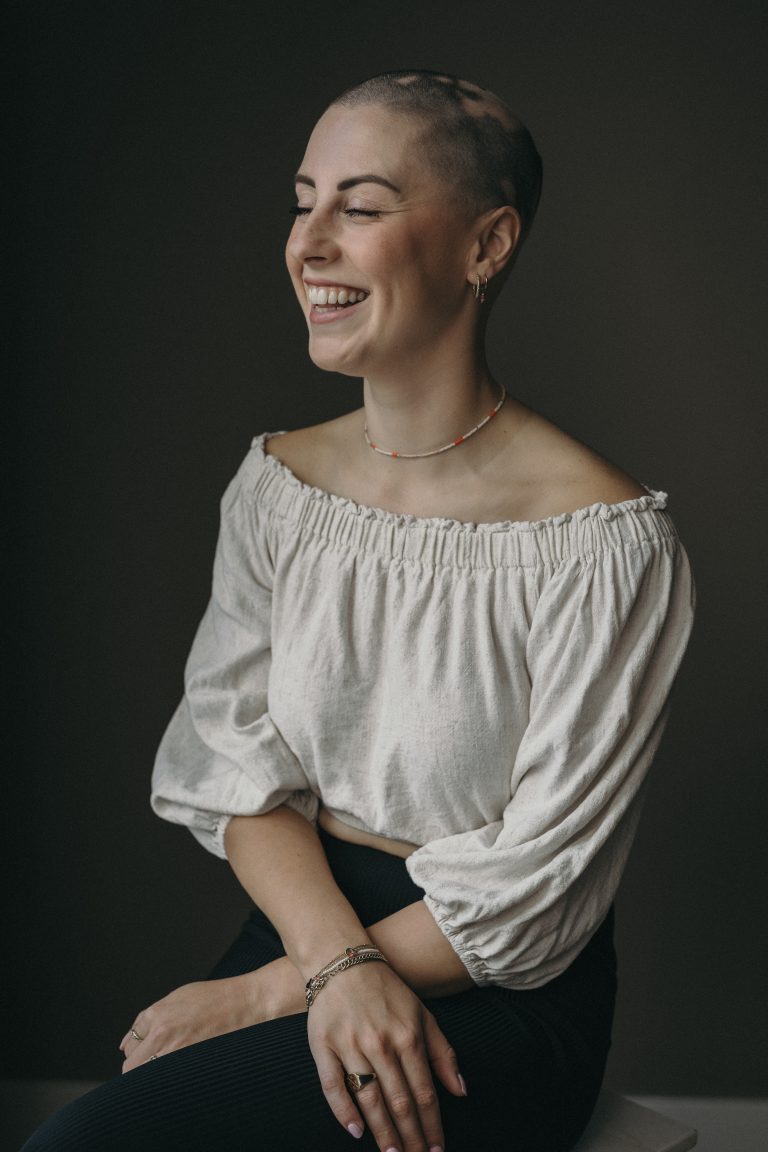 alopecia portret haaruitval